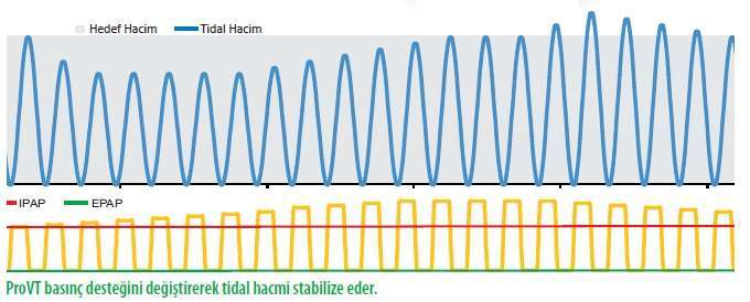 SleepOne ProVT (Bipap S/T AVAPS)
